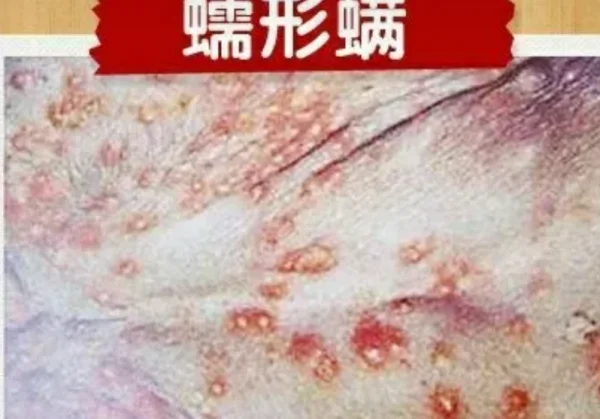 细菌性皮肤病是如何引起的呢？细菌性皮肤病的种类有哪些？-第5张图片-爱游哥学习网