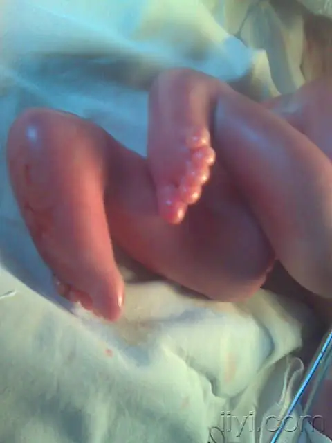 火胶棉婴儿胶图片 火胶棉体婴儿图片 火棉胶婴儿恐怖图-第5张图片-爱游哥学习网