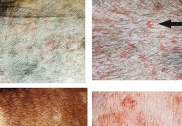 细菌性皮肤病是如何引起的呢？细菌性皮肤病的种类有哪些？-第12张图片-爱游哥学习网