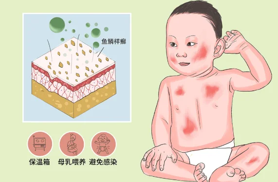 火胶棉婴儿胶图片 火胶棉体婴儿图片 火棉胶婴儿恐怖图-第11张图片-爱游哥学习网