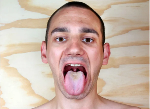 大便不成形粘马桶还臭是什么原因-第7张图片-爱游哥学习网